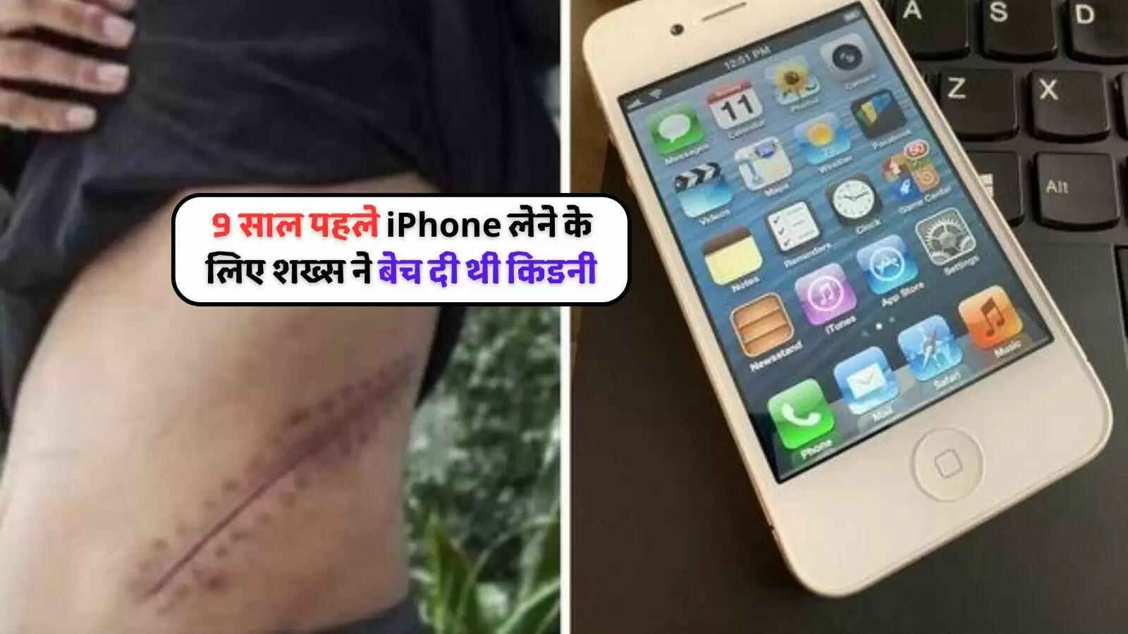 man-sold-his-kidney-for-iphone