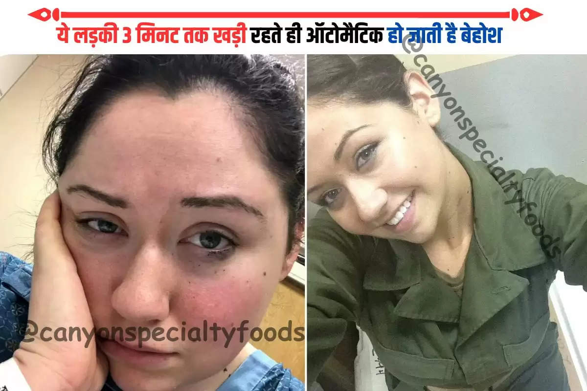 shocking-woman-allergic-to-gravity-faints-ten-times-a-day-news-in-hindi