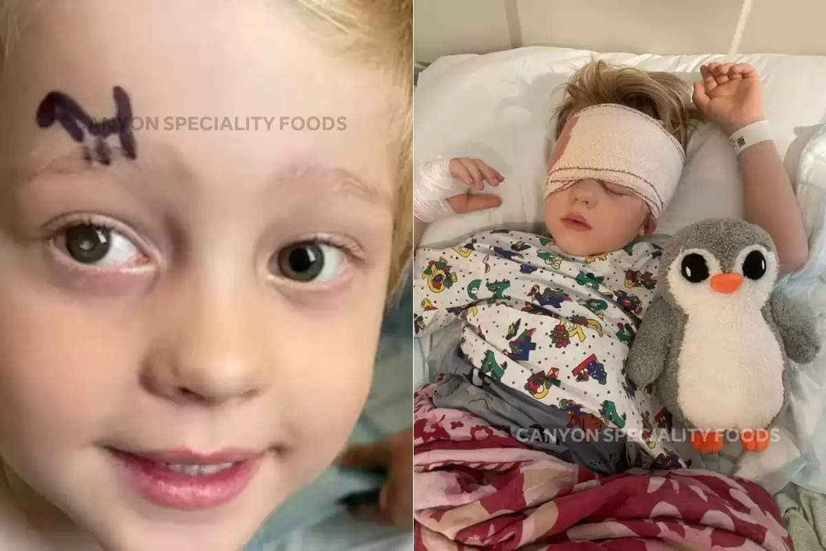 Megan Brimson, Retinoblastoma, Symptoms of Retinoblastoma, England Mother, sinister reason behind white glow, Rare illness, shocking news, bizarre news, Royal London Hospital, Isle of Wight, Childhood Eye Cancer Trust,