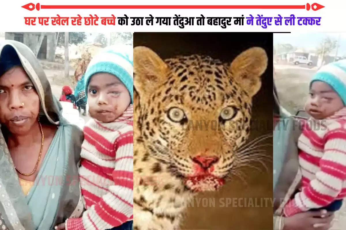 leopard attacked child (1)